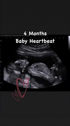 4 Months Baby Heartbeat 💙 #jerbearimaging #athomeultrasound #heartbeat #babyontheway #ultrasound