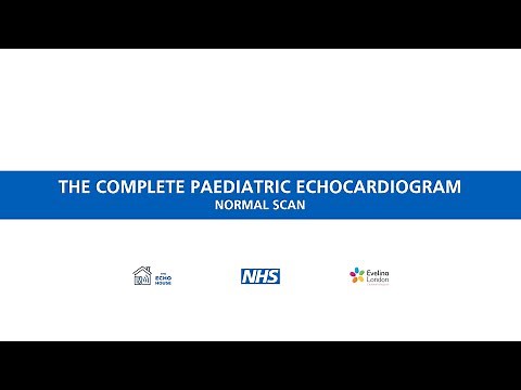 The complete paediatric echocardiogram - Normal scan