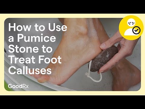 How to Use a Pumice Stone to Treat Foot Calluses | GoodRx