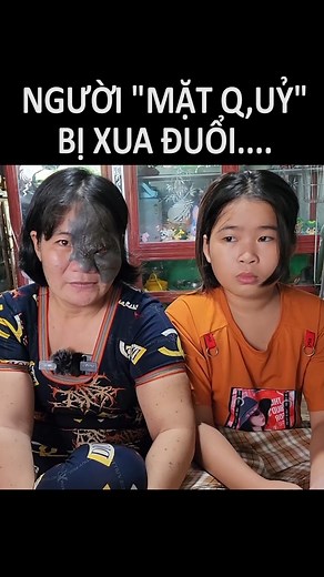296K views · 1.8K reactions | Chị vé số mang gương mặt dị dạng bị người đời xua đuổi vì nhìn sợ tối gặp ác mộng, gọi chị là người "mặt qu,ỷ"... #nhanchungchannel #NCC #reels #reelsvn #MCV | Nhân Chứng Channel | Facebook