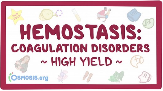 Coagulation disorders: Pathology review: Video, Causes, & Meaning | Osmosis
