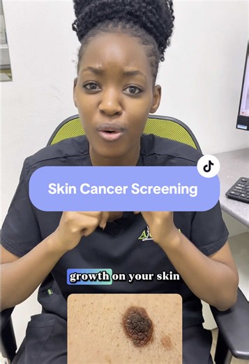 Skin Cancer Screening at Advanced Skin Clinic