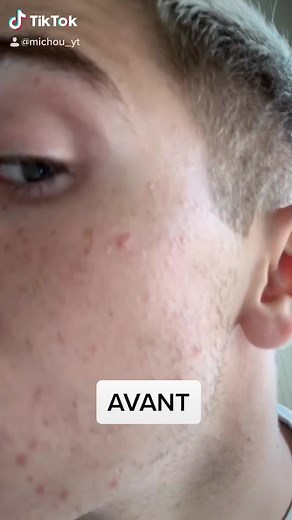 Comment convaincre sa crush avec l'Effaclar Challenge de Michou ? 😂😎