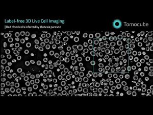 Babesia-Infected Red Blood Cells | 3D Live Cell Time-Lapse Imaging with Holotomography