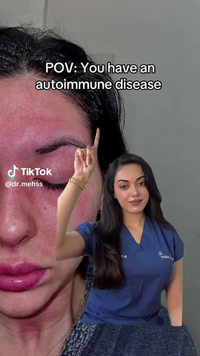 Understanding Autoimmune Skin Symptoms and Diagnosis