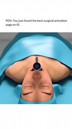 Animations on Instagram: "Follow @surgicalanimation for more! 💊"
