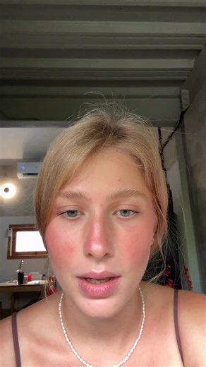 MODEL MARY | Blonde with a soul on Instagram: "Di umur berapa kalian kena cacar guys?"