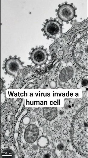 What a virus looks like invading a human cell under the microscope. #biology #microscope #virus