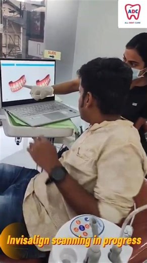 Invisalign scanning under progress