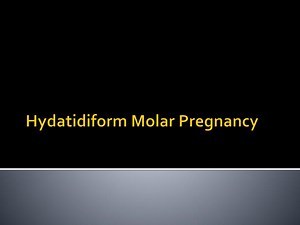 Hydatidiform Molar Pregnancy - SlideServe