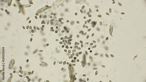 a large colony of ciliates Coleps, which are largely located in dirty water under a microscope