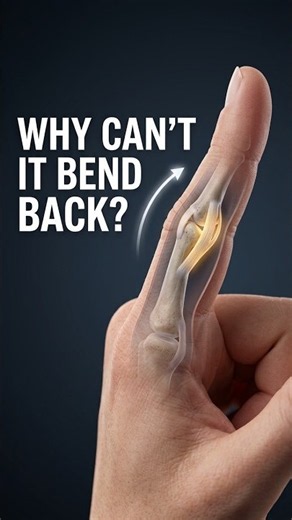 Why Can’t You Bend Your Finger Far Backward? 🖐️🦴