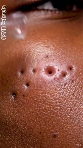 ASMR Extracts | Full Suction