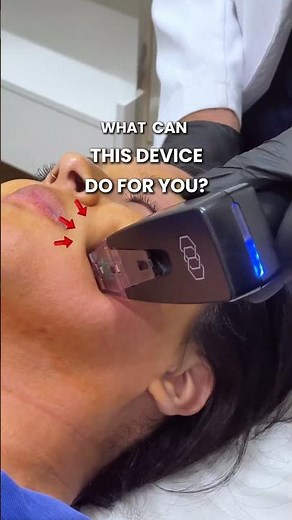 What can Morpheus8 do for you? Let’s break it down.