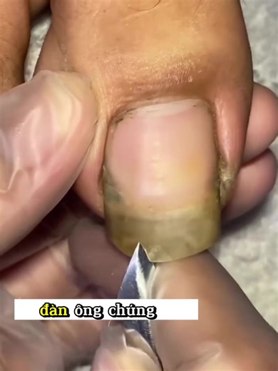 Lấy khoé siêu phê #laykhoe #laykhoemong #laykhoemongchan #laykhoechan #taovamich