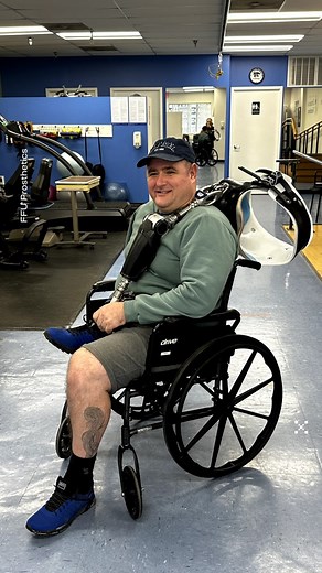 Євген Калюжний буквально прийняв на себе удар ворога — російська міна вибухнула просто на його бронежилеті, унаслідок чого захисник втратив праві руку та ногу. Його ампутація надскладна через те, що вона одностороння, проте фахівці Medical Center Orthotics & Prosthetics взялися за протезування українського військового і зробили для нього два сучасні протези. Тож Євген знову вчиться ходити та опановувати свої «технологічні» кінцівки. Бажаємо нашому захиснику успішної реабілітації та якнайшвидшого