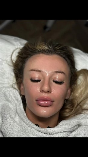 15 reactions · 6 comments | I have loved seeing the difference in these before and afters. You can see how the texture, skin tone, breakouts and pores have dramatically improved from before pictures with this particular treatment. #ResultsDrivenSkincare #SkinTransformation #BeforeAndAfterSkin #FacialTreatment #skinbarrierrepair | _gentle_aesthetics_ | Facebook