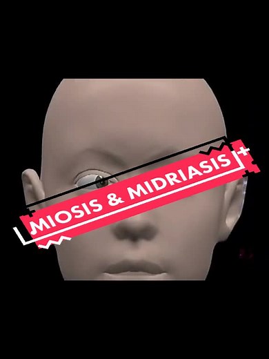 #medicina #salud Miosis y midriasis #ojo #vista #oftalmologia #YoSoyCreador #fyp @andreaevesaliusmd @andreaevesaliusmd