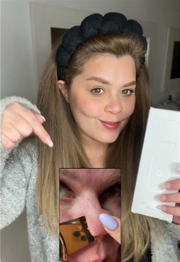 Ultrasonic Scrubber: The Ultimate Skincare Tool