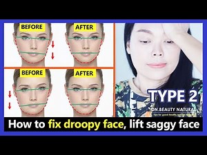 (Type 2) How to fix droopy face, lift saggy face, face exercises for sagging face and uneven faces.