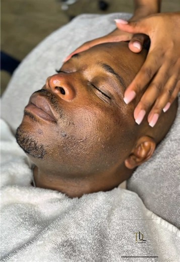 Glycolic Acid Chemical Peel for Radiant Skin
