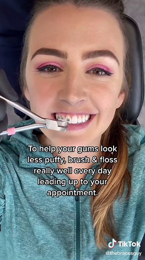 Getting Braces Off Soon? Tips and Tricks for Easy Transition