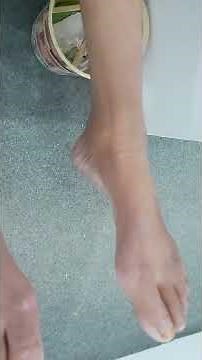 foot drop | High steppage gait | Neuropathic gait | Department of medicine