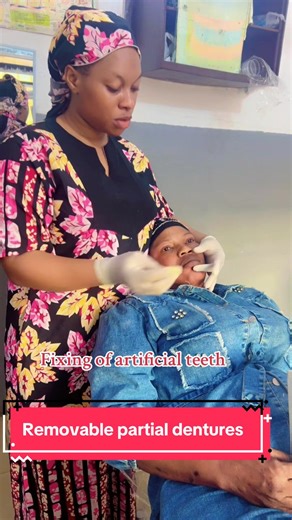 Removable Partial Dentures for Missing Teeth Replacement