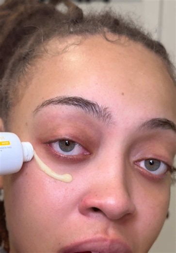 My SKIN AFTER USING THIS PRODUCT 😱 Search Tosowoong Kojic Acid Cream on Amazon! @TOSOWOONG US #tosowoong #kojicacidcream #darkspotcare #amazonbeauty #amazonprimeday