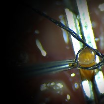 Video: Murine Cervical Aortic Transplantation Model using a Modified Non-Suture Cuff Technique