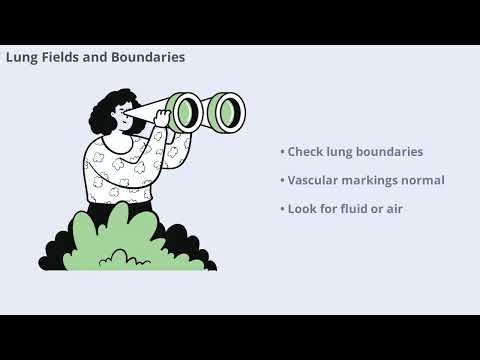 How to Read a Chest X-Ray: The Complete Step-by-Step Guide
