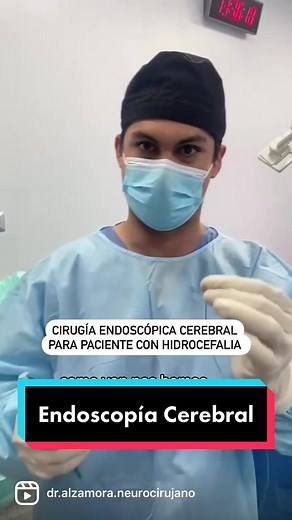 Endoscopía Cerebral - Neuroendoscopía Aquí comparto algunas imágenes de un caso de endoscopía cerebral en una paciente con HIDROCEFALIA. La cirugía realizada fue una tercer ventriculostomía endoscópica. En esta técnica se utiliza un pequeño balón para crear una comunicación entre los ventrículos cerebrales y el espacio subaracnoideo. De esta forma se puede ayudar a pacientes con hidrocefalia sin necesidad de colocar prótesis como los sistemas de derivación ventrículo-peritoneal (DVP) o ventrícul