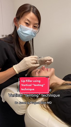 Lip Filler Vertical Tenting Technique Tutorial