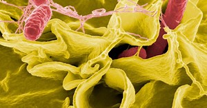 Salmonella: CDC investigating outbreak linked to unknown food source