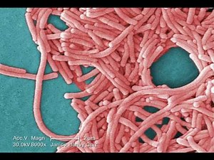 Legionnaires' Disease: What You Need to Know