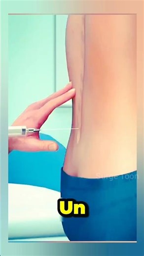 3D Cartoon Surgery: Doctor Giving Injection on Stomach#CartoonSurgery #3DAnimation