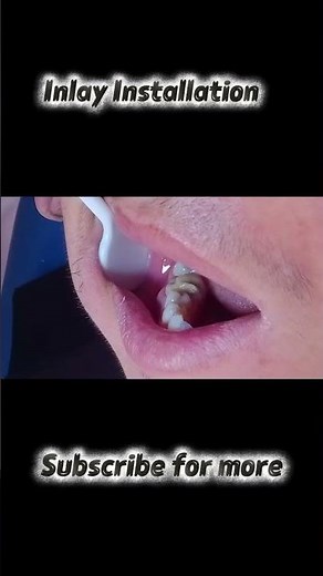 We Installed Inlays in a $50 Tool Box!