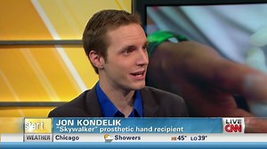 Actor gets 'Luke Skywalker' hand