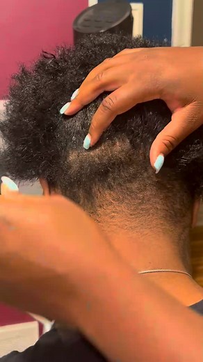 Fast Aggressive Dandruff Scratching ｜ Random Parting ｜ Scalp Check 000 | Yuriy Shatsky