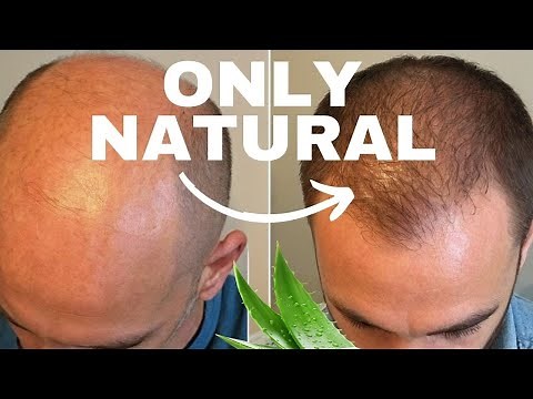 DHT Blockers for Hair Growth - Top 6 Natural Options