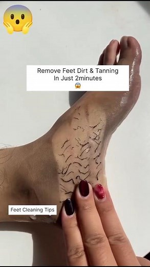 🫶Remover Feet Dirt & Tanning In 1 Ues/Clean All Dirt & Tanning | #shorts #ytshorts #feet #handcare