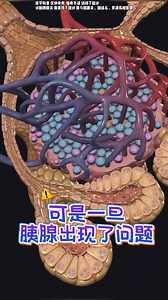 可怕的胰腺炎！ #胰腺炎 #胰腺 #胰島素 #抖出健康知識寶藏 #健康科普有真知 | 康復吳生