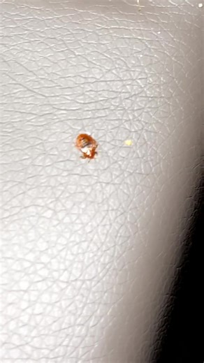 Interventions rapides en dératisation à Paris