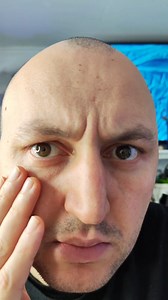 25K views · 245 reactions | EYE UNDER A MICROSCOPE #science #microscope #microscopy #eye | Mir Glazami Microscopa | Facebook