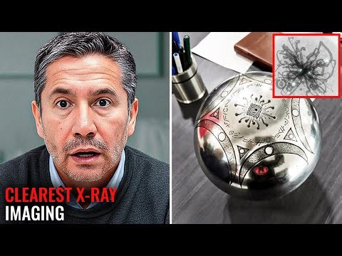 Scientist Reveals the Buga Sphere’s Interior Through the Clearest X-Ray Imaging