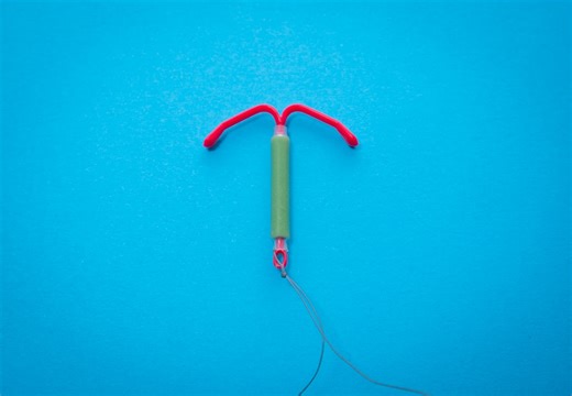 I had to get my IUD surgically removed after years of random pain.