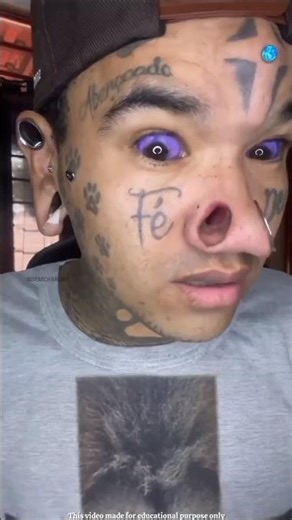 "Extreme Body Modification: Self-Expression or Too Far?"😰