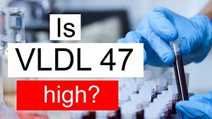 Is VLDL 47 high, normal or dangerous? What does Very low density lipoprotein level 47 mean?