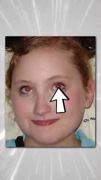 The REAL reason for RED EYES in photos... 😈 @V2F