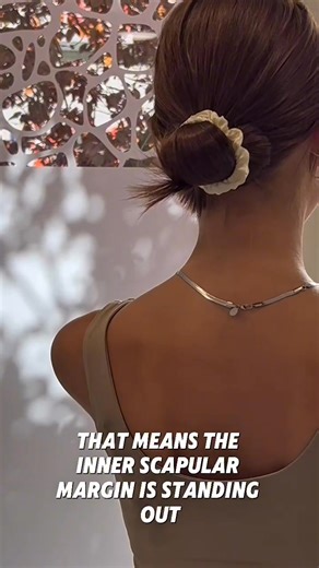 6.3K views · 15 reactions | Scapula alata einfach erklärt! Gemeinsam...